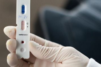 Covid-19: Secretaria Municipal da Saúde chama atenção para medidas de prevenção