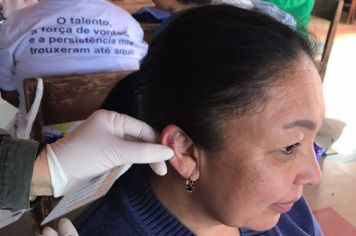 Atividade de Auriculoterapia para participantes do NAAB no Bairro Renascer