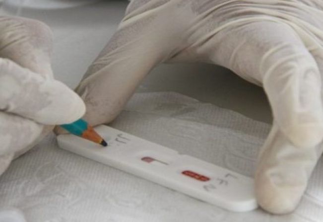 Covid-19: Secretaria Municipal da Saúde chama atenção para medidas de prevenção